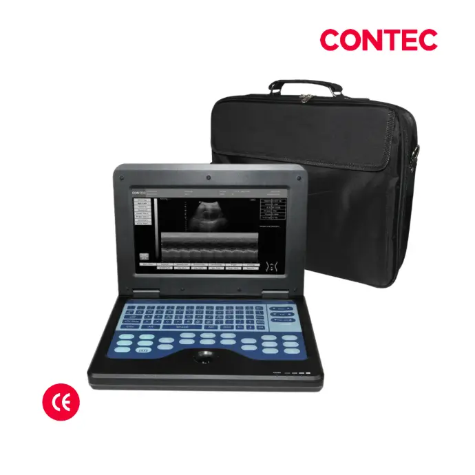 Ecografo portatil 10_ tipo laptop, + 1 transductor convexo8 (1).webp