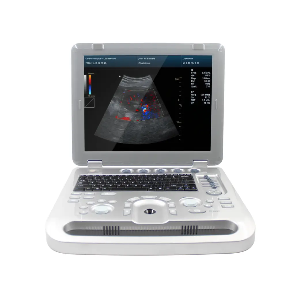 ecografo doppler color.webp